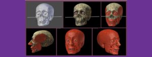 Reconstrução facial forense: a ajuda da impressão 3D